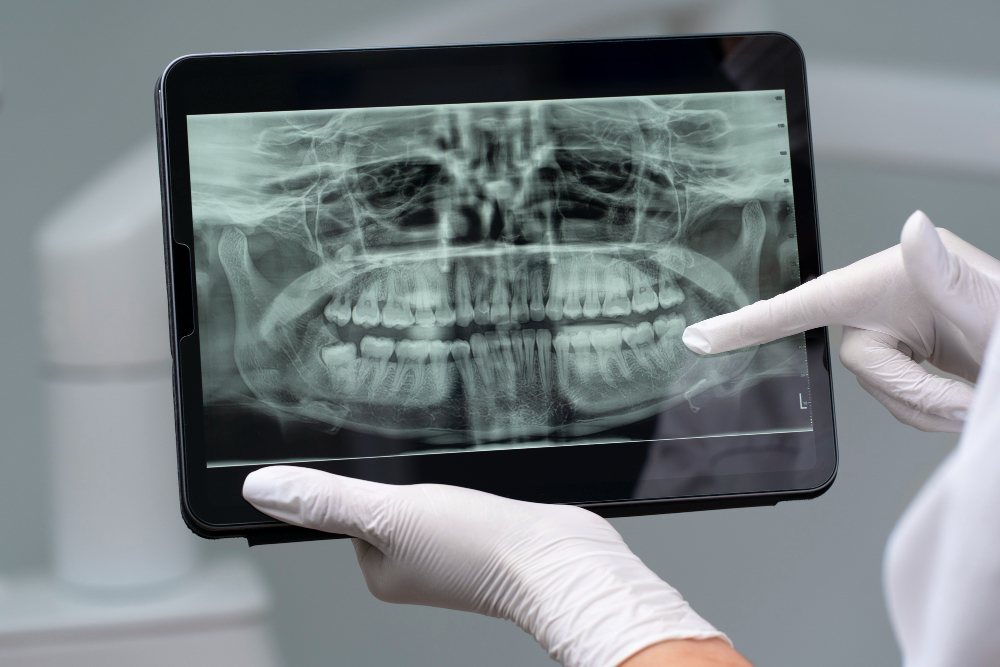 Digital X-Rays Covina, CA