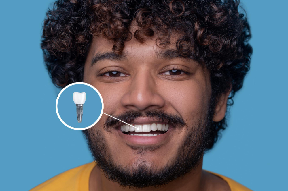 Implant Restoration Covina, CA