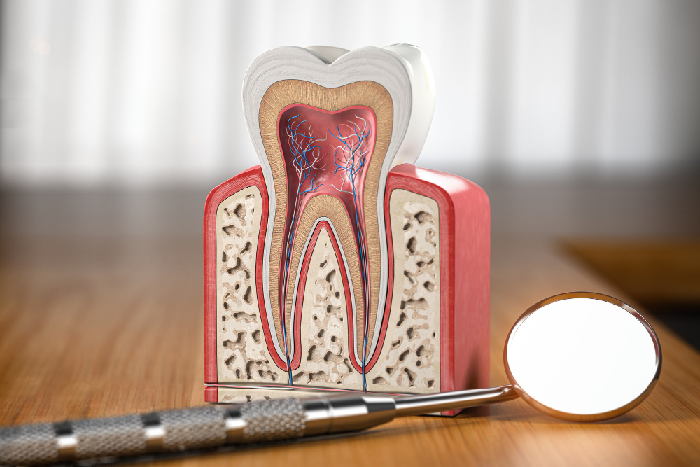 Root Canals Covina, CA