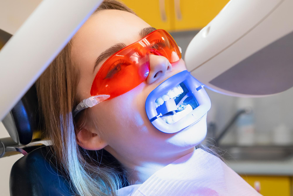 Teeth Whitening Covina, CA